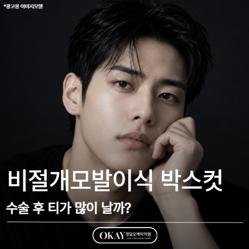 비절개모발이식 박스컷, 수술 후 티가 많이 날까? 관련 이미지 1