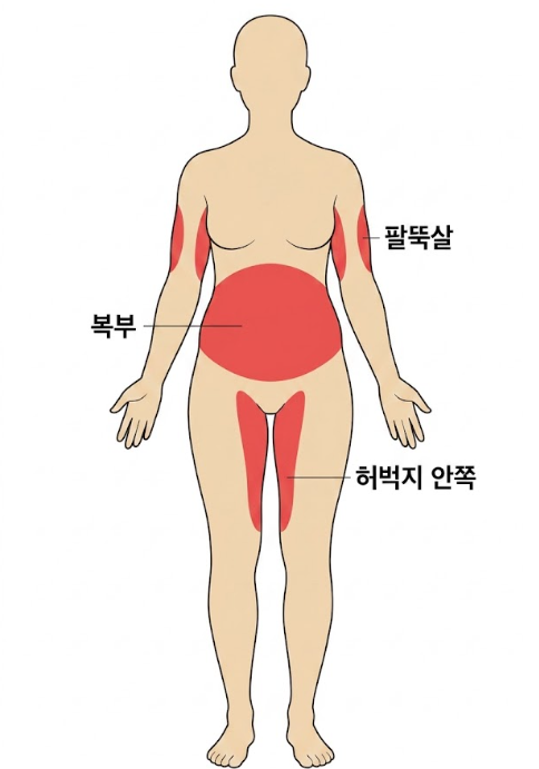 Fat-Dissolving Injections vs. Liposuction: Which Option Is Right for Me? image 5