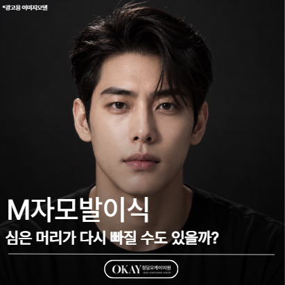 M자모발이식, 심은 머리가 다시 빠질 수도 있을까? 관련 이미지 1