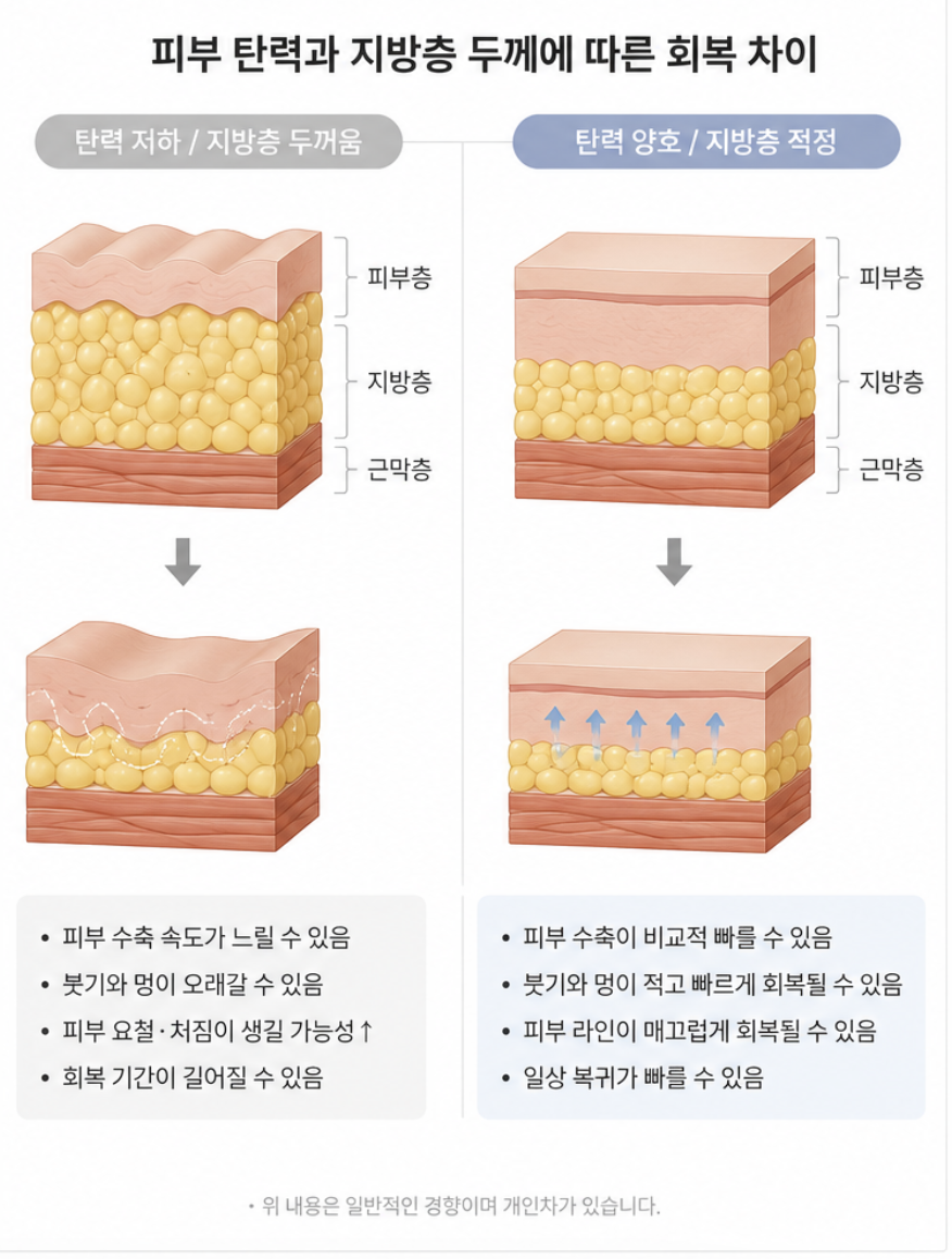 허벅지지방흡입 출근, 며칠부터 가능할까요? 회복 과정 함께 알아보기 관련 이미지 6