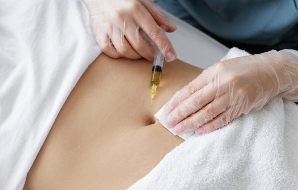 Side Waist Liposuction: Who Develops Side Effects (Bruising·Swelling·Unevenness) and Who Doesn't image 4
