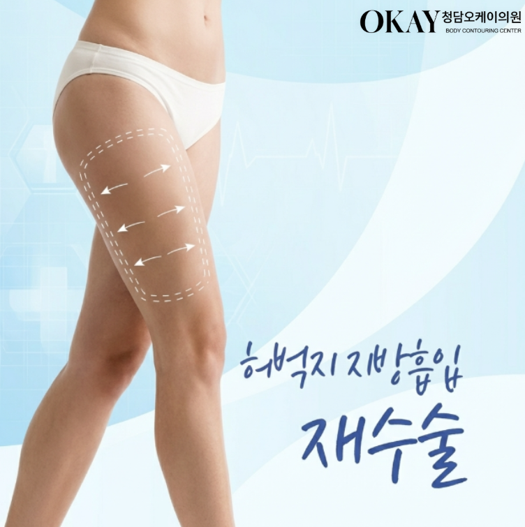 허벅지지방흡입재수술, 결과가 만족스럽지 않을 때 교정 가능한 범위는? 관련 이미지 2