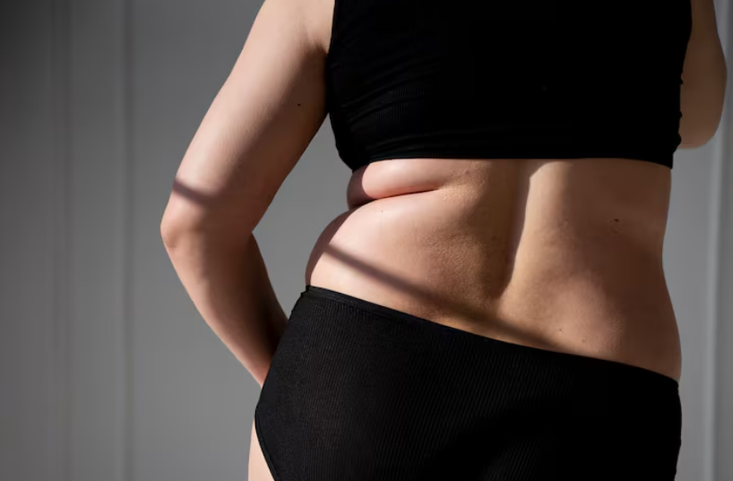허리살빼기, 지방흡입 후 허리라인은 얼마나 달라질까요? 관련 이미지 2