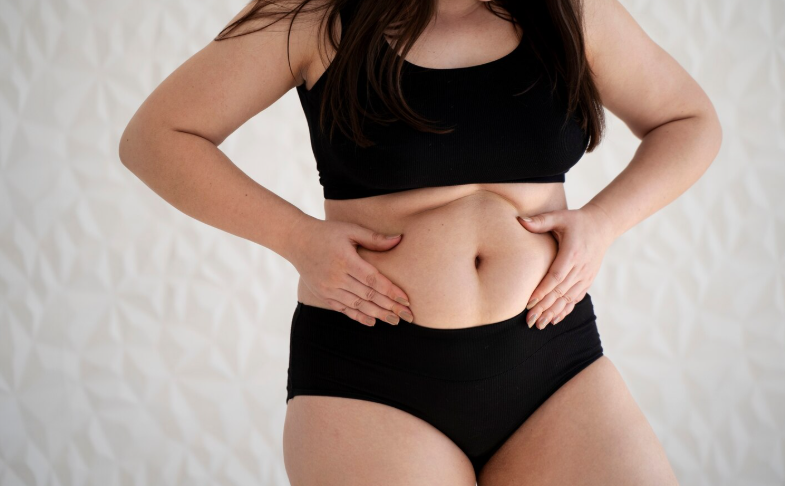 복부지방흡입 후 회복 과정, 언제부터 라인이 달라질까요? 관련 이미지 2
