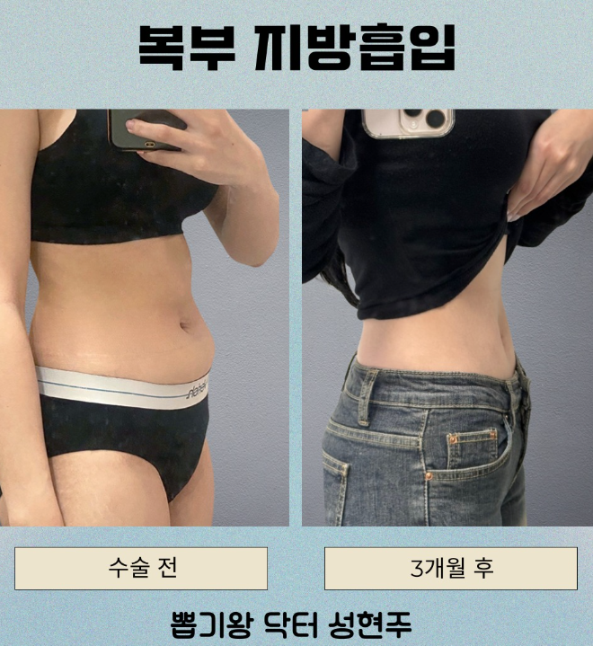 옆구리살빼는법, 유독 러브핸들만 안 빠지는 이유는? 관련 이미지 8
