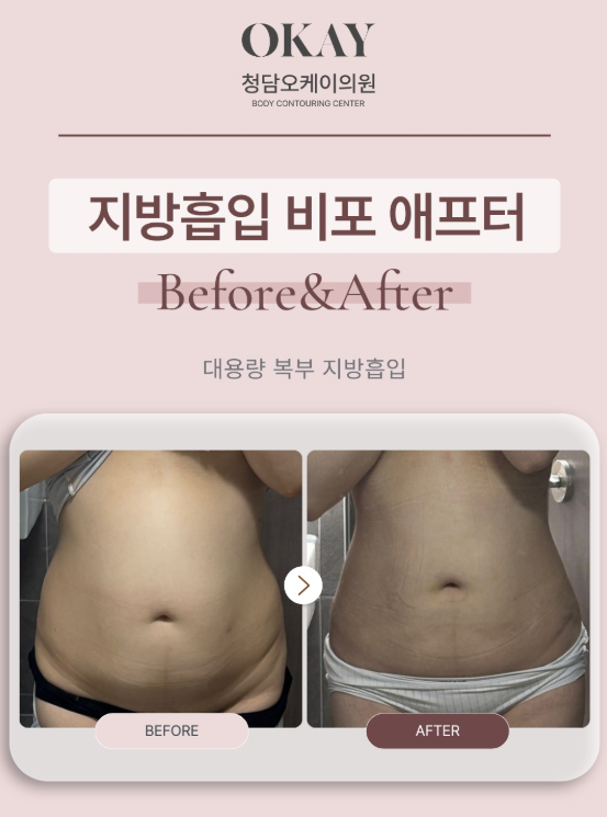 연예인허리라인, 마른 몸보다 중요한 건 따로 있다? 관련 이미지 6