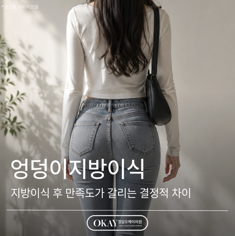 엉덩이지방이식 후 만족도가 갈리는 결정적 차이 관련 이미지 1