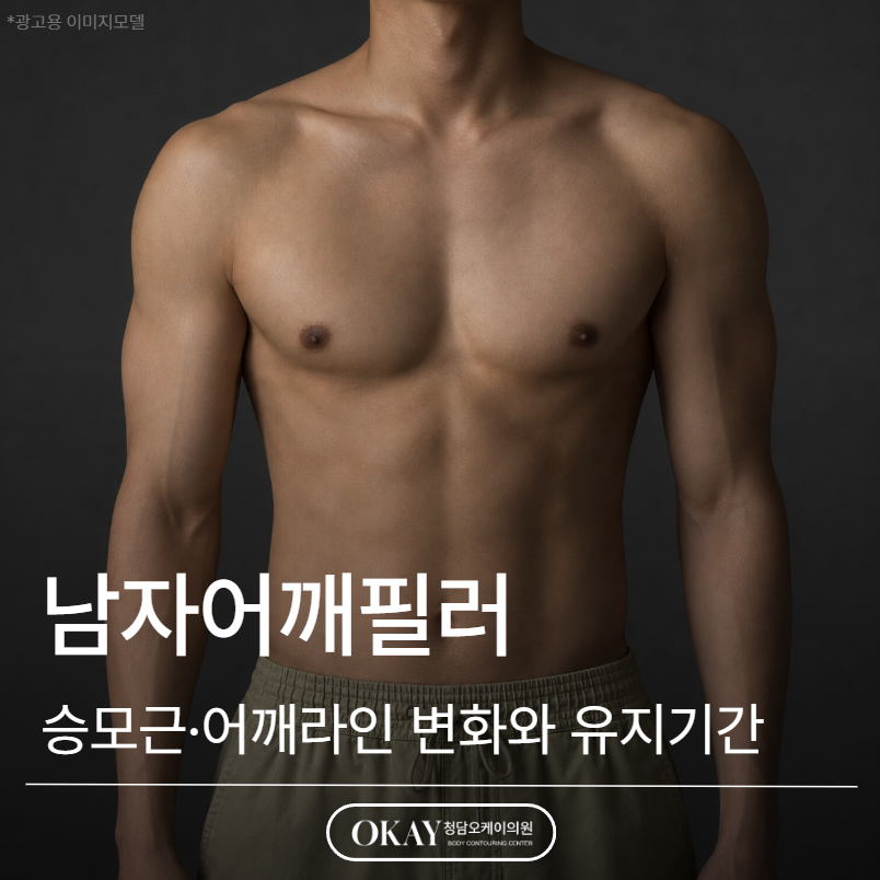 Men’s Shoulder Filler: Explaining Trapezius and Shoulder Line Changes and How Long They Last image 1