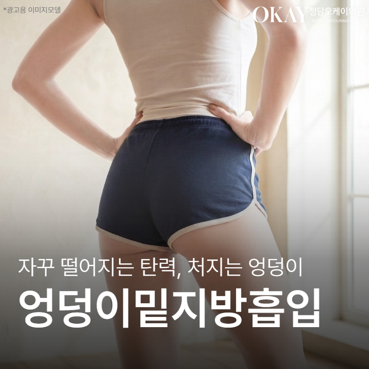 Subgluteal Liposuction: Why Results Differ Depending on Skin Elasticity and Sagging image 1