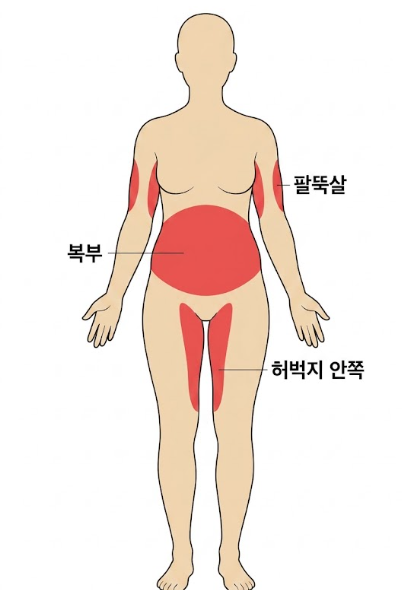 지방흡입잘하는병원 찾는다면? 부위보다 중요한 건 전체 라인 관련 이미지 3