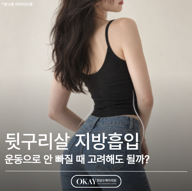 뒷구리살 지방흡입, 운동으로 안 빠질 때 고려해도 될까? 관련 이미지 1