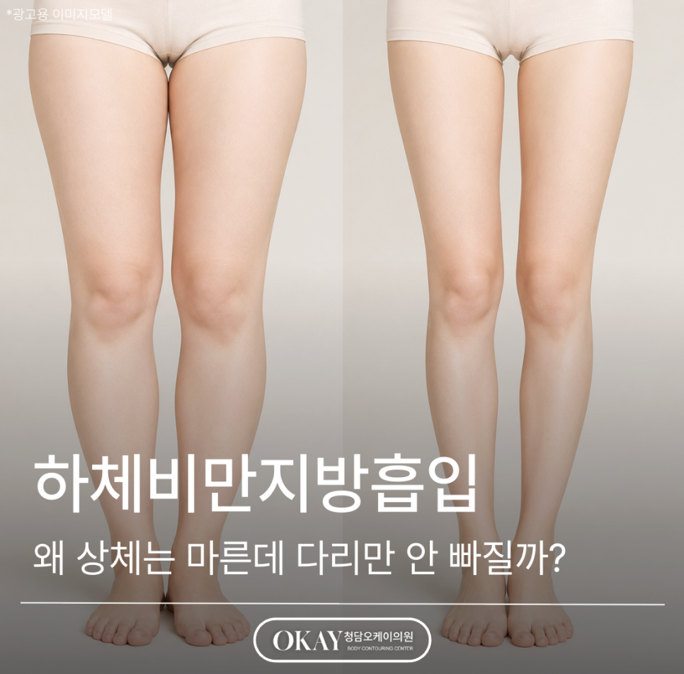 하체비만지방흡입, 왜 상체는 마른데 다리만 안 빠질까? 관련 이미지 1