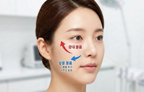팔자주름 지방이식 전후 차이 얼마나 날까? 가격과 생착률, 유지기간까지 정리해드립니다 관련 이미지 6