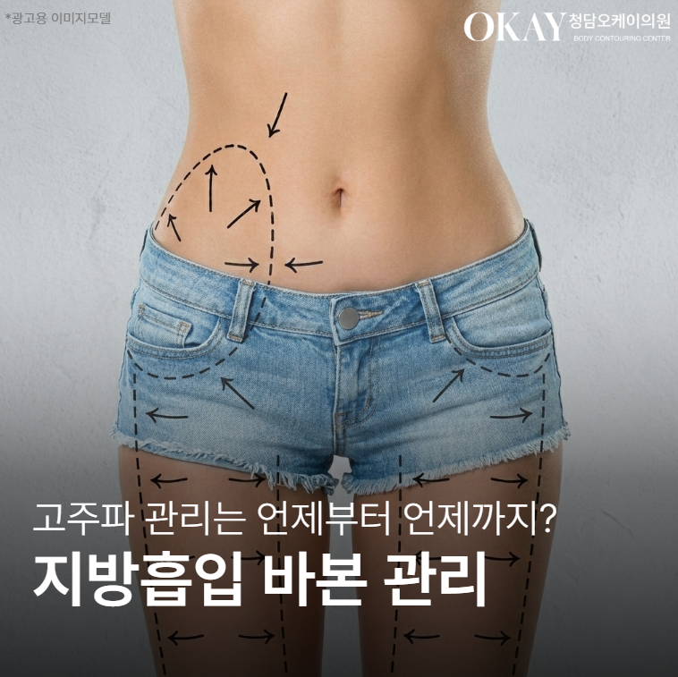 지방흡입 바본 관리 고주파&middot;바이오본드 언제부터 해야 하는지 정리했습니다 관련 이미지 1