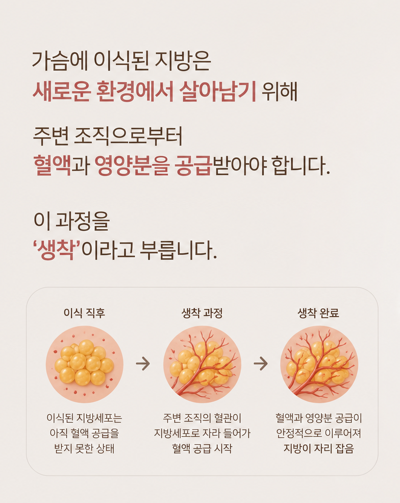 가슴지방이식 후 볼륨이 줄어드는 이유 알려드립니다 관련 이미지 5