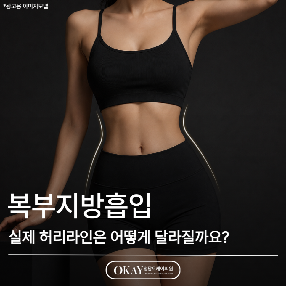 복부지방흡입 후기, 실제 허리라인은 어떻게 달라질까요? 관련 이미지 1