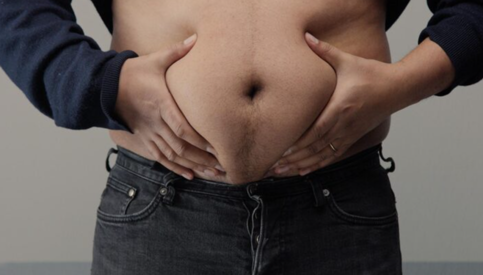 남자지방흡입, 술배처럼 나온 복부 어디까지 줄일 수 있을까요? 관련 이미지 5