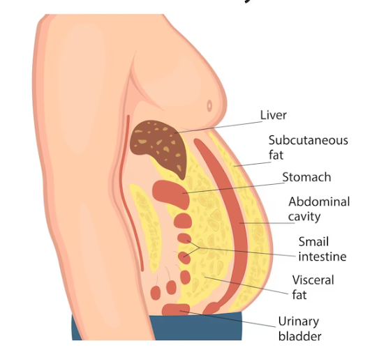 복부비만치료, 유독 뱃살만 안 빠지는 이유는 따로 있을까요? 관련 이미지 6