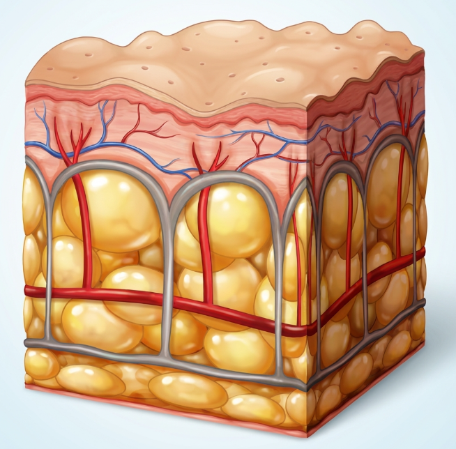 Will Facial Liposuction Swelling Still Be There After a Week? Swelling Duration and Recovery Process image 9