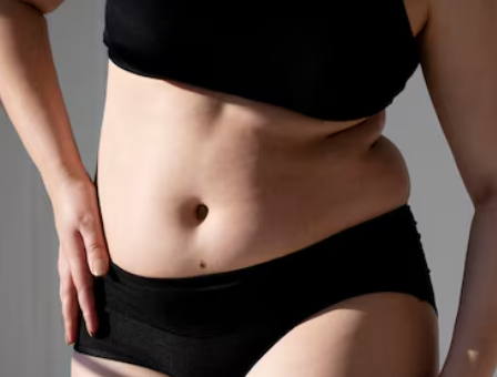 After Childbirth, You Need to First Distinguish Between Sagging Belly and Fat image 5