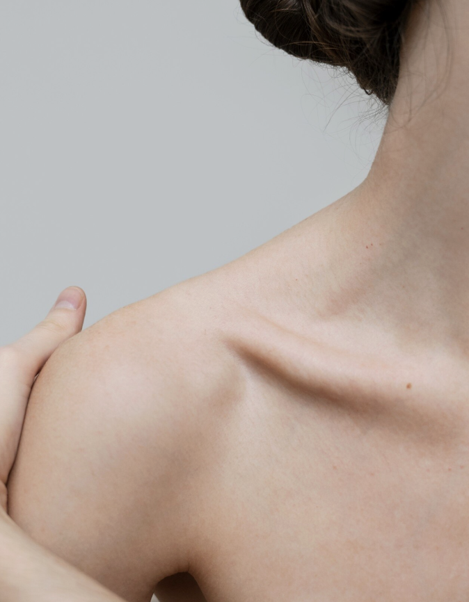 What to Do If You Experience Shoulder Filler Side Effects: Stay Calm and Check These Points image 4