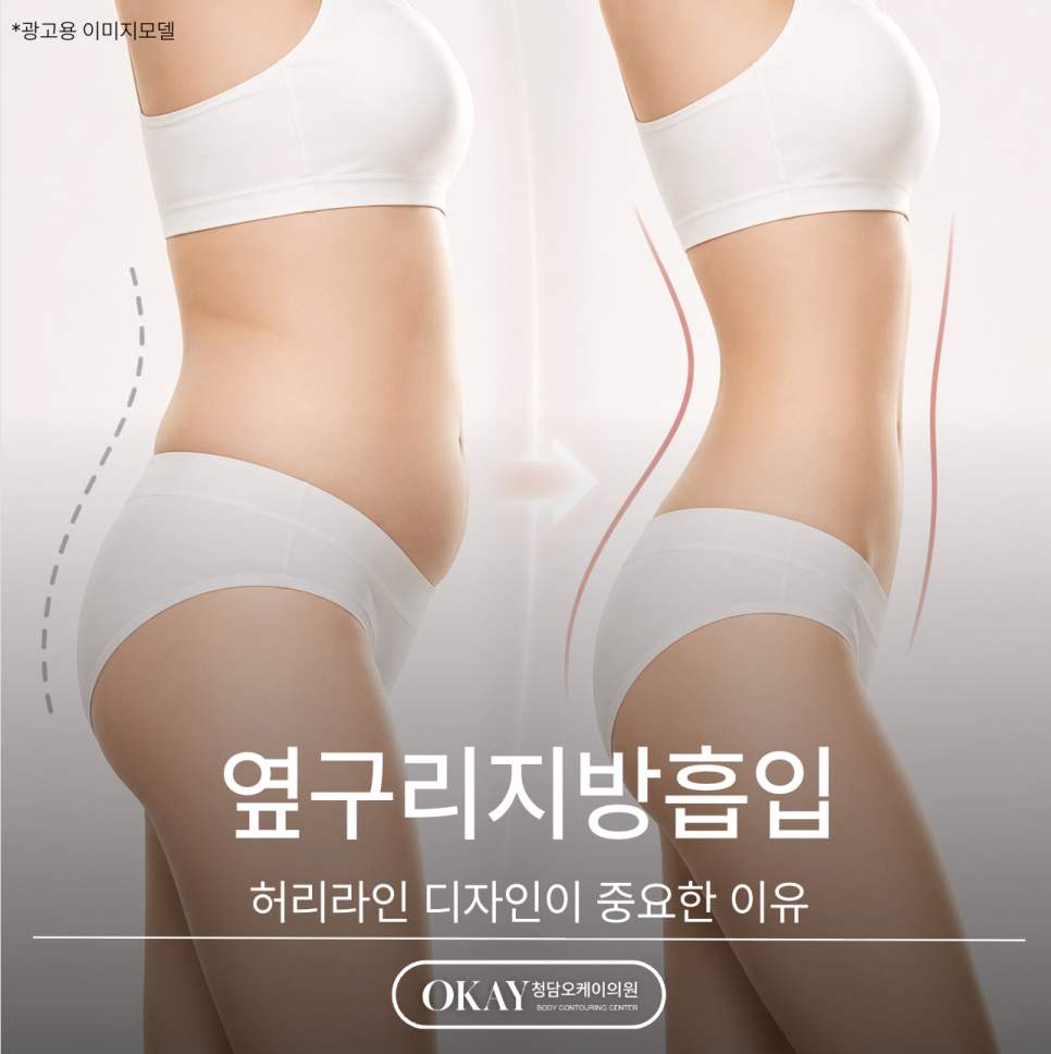 옆구리지방흡입, 허리라인 디자인이 중요한 이유 관련 이미지 1