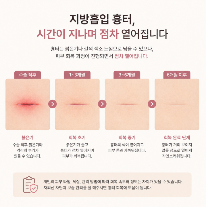 지흡흉터 언제 흐려질까? 치료·레이저·관리 방법 함께 정리 관련 이미지 6