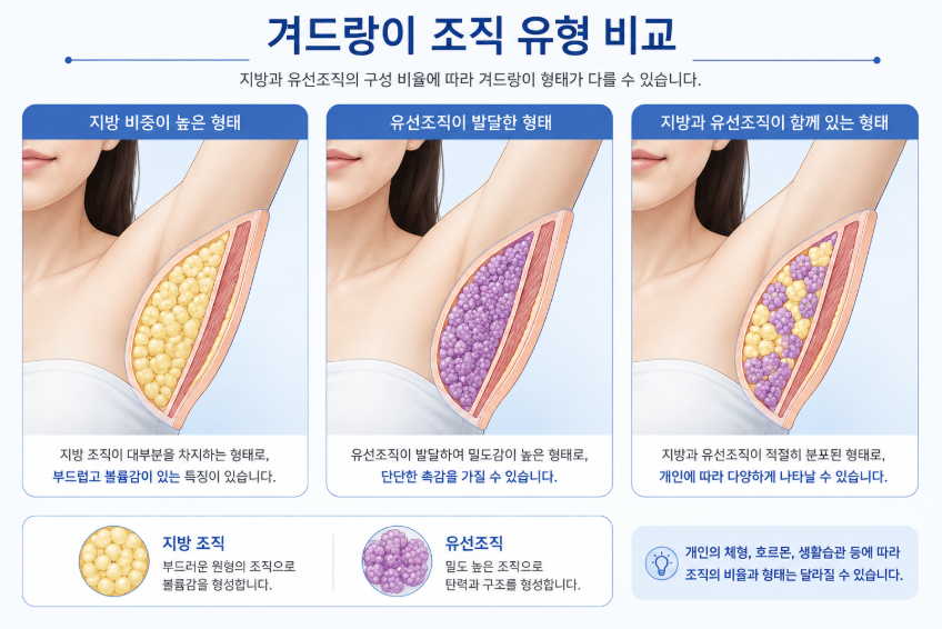 부유방수술비용, 지방흡입만 하면 더 저렴할까요? 관련 이미지 4