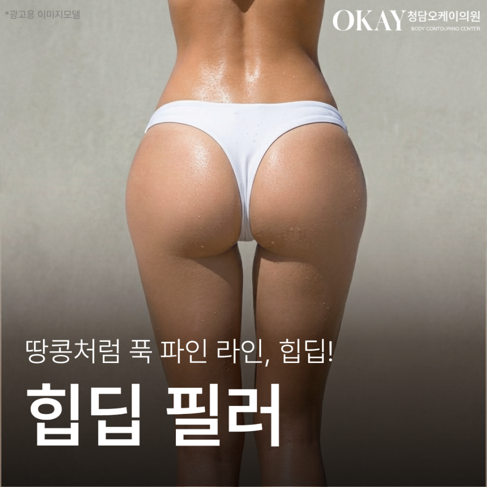 힙딥필러, 땅콩골반이 스트레스라면? 전후 변화&middot;용량&middot;유지기간까지 정리 관련 이미지 1