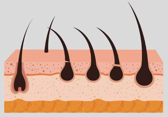 Side Effects of Non-Incision Hair Transplant: A Summary of the Most Common Cases image 3