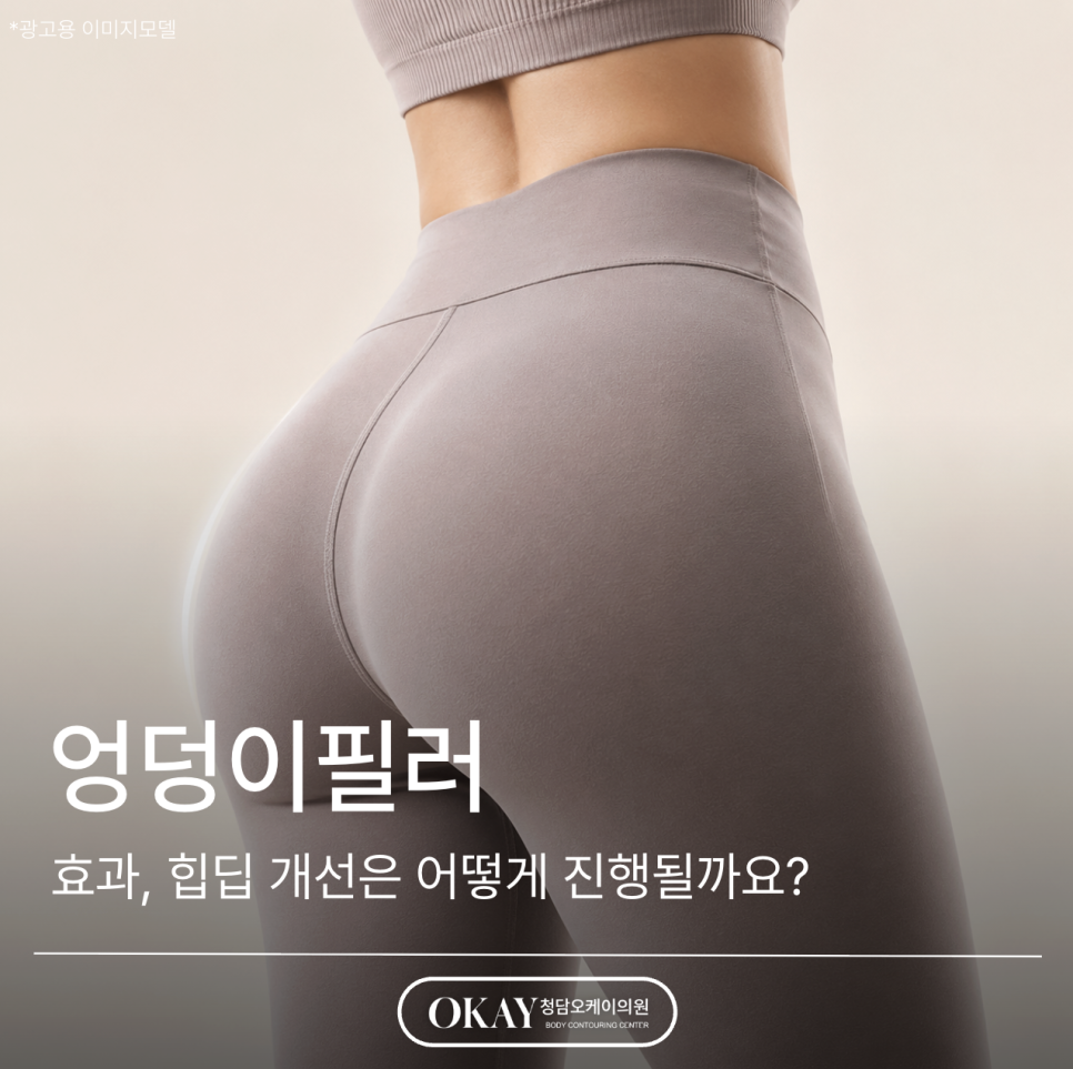 엉덩이필러 효과, 힙딥 개선은 어떻게 진행될까요? 관련 이미지 1