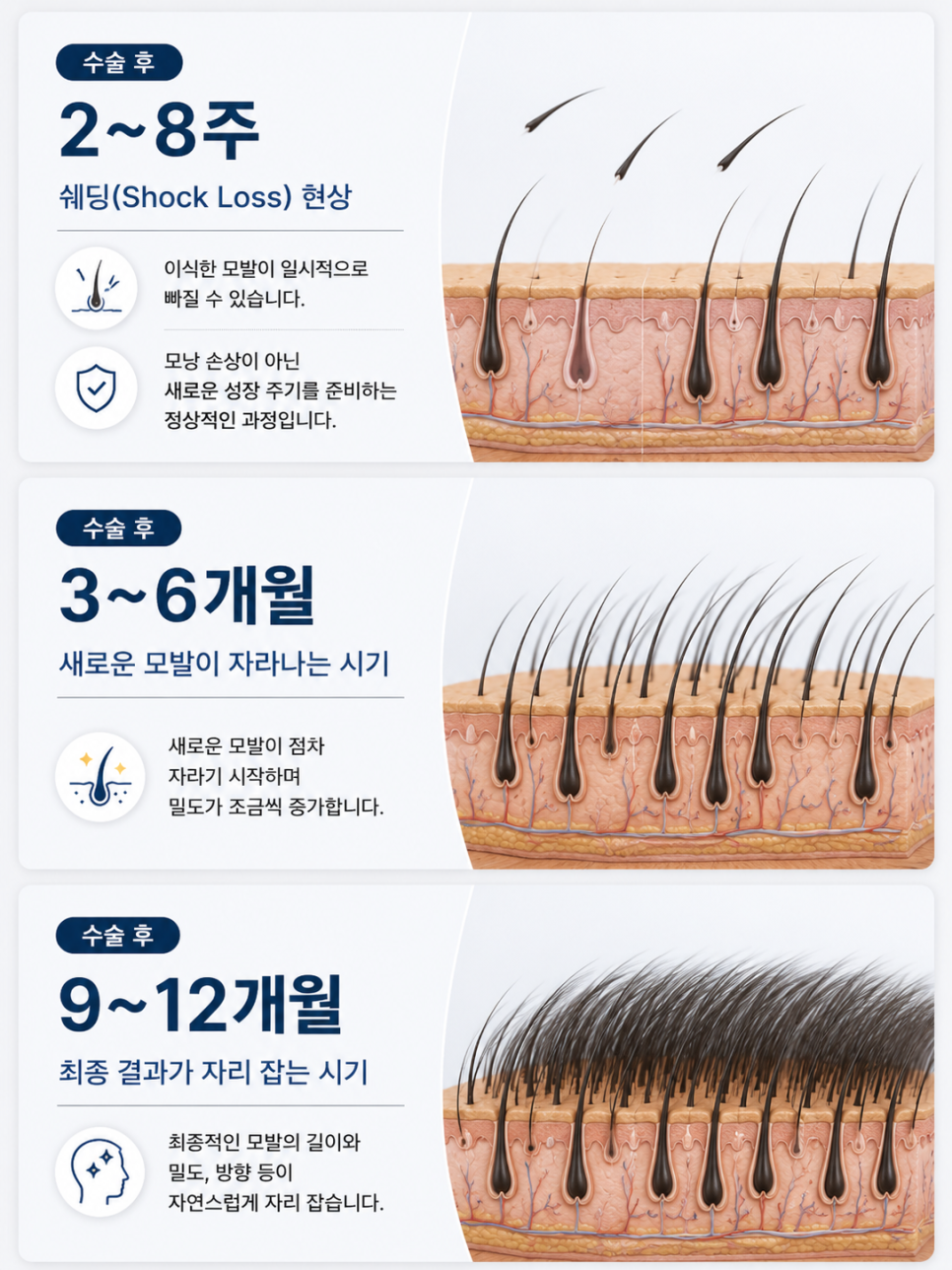 모발이식생착기간, 언제부터 안심해도 될까요? 딱지·운동·모자까지 총정리 관련 이미지 7