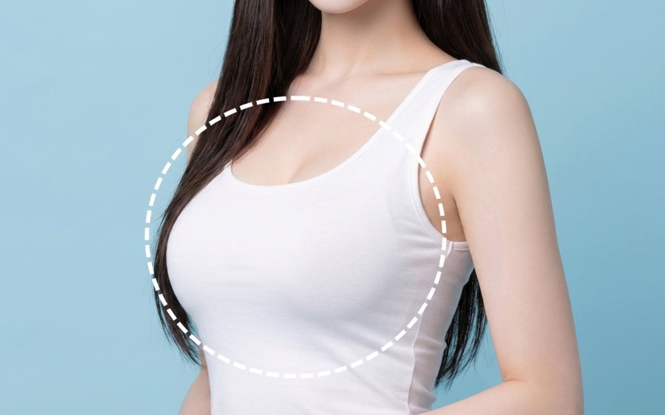 가슴확대수술 보형물 vs 자가지방이식 어떤 차이 있을까 전후 후기 부작용까지 관련 이미지 2