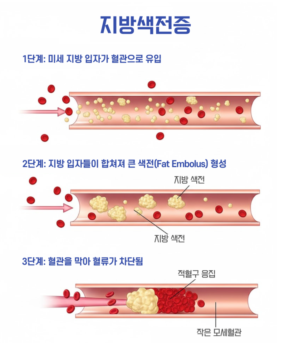 [청담오케이의원] 지방흡입, 정말 안전한 수술일까? 관련 이미지 4