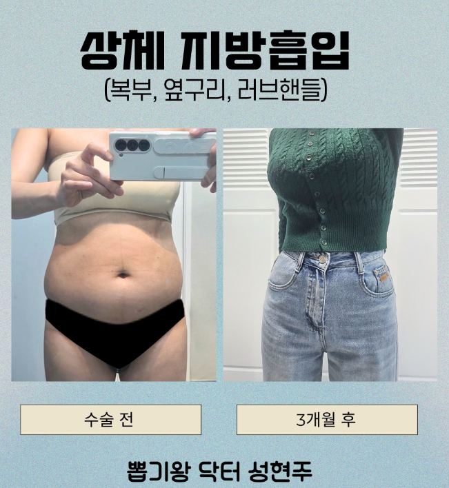 옆구리살빼는법, 유독 러브핸들만 안 빠지는 이유는? 관련 이미지 10