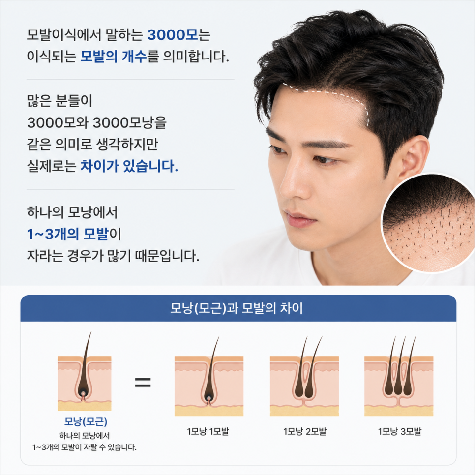 Is 3,000 Grafts Enough for a Hair Transplant? A Complete Guide from Design to Coverage image 2
