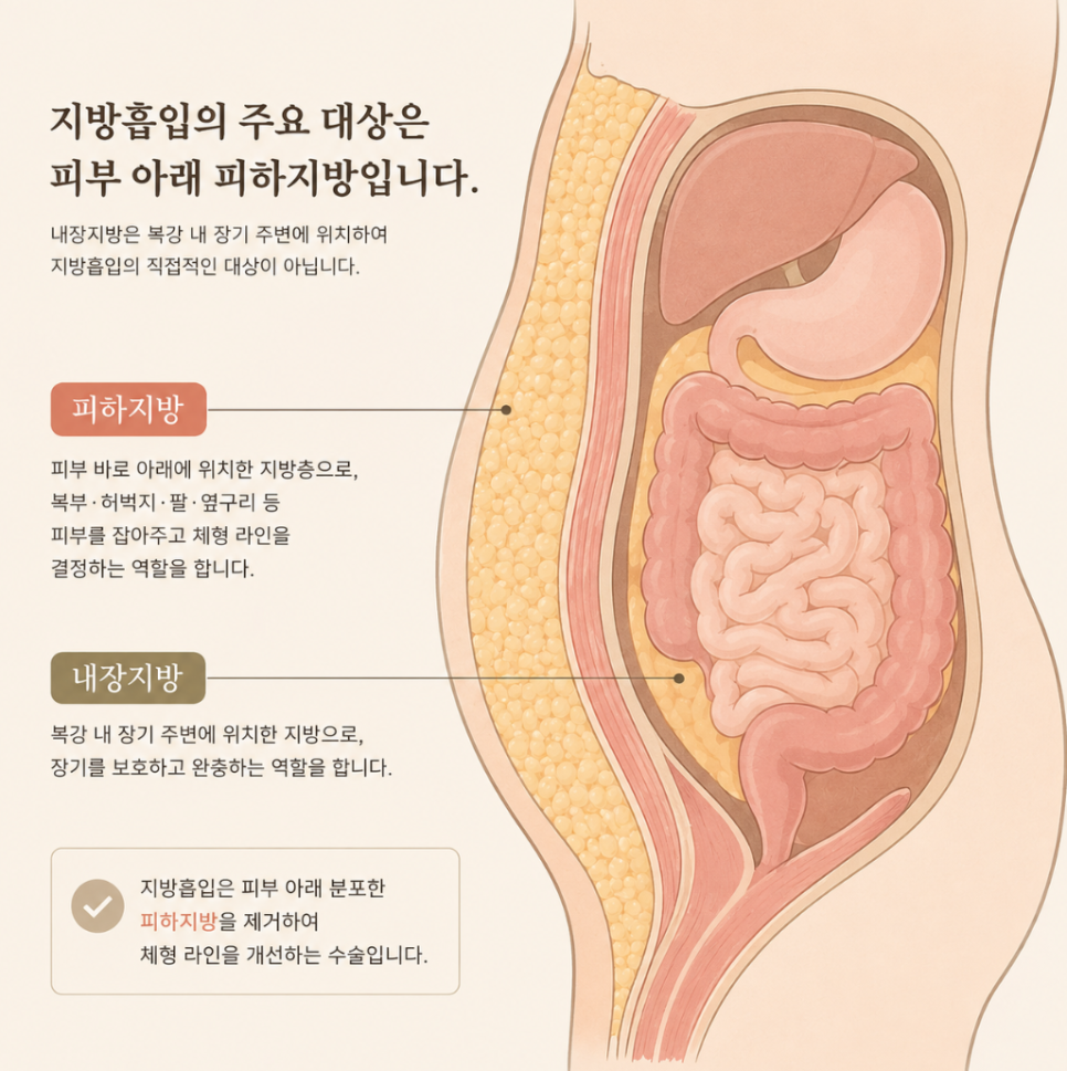 Liposuction for Severe Obesity: What Must Be Checked When Performing Large-Volume Liposuction? image 3