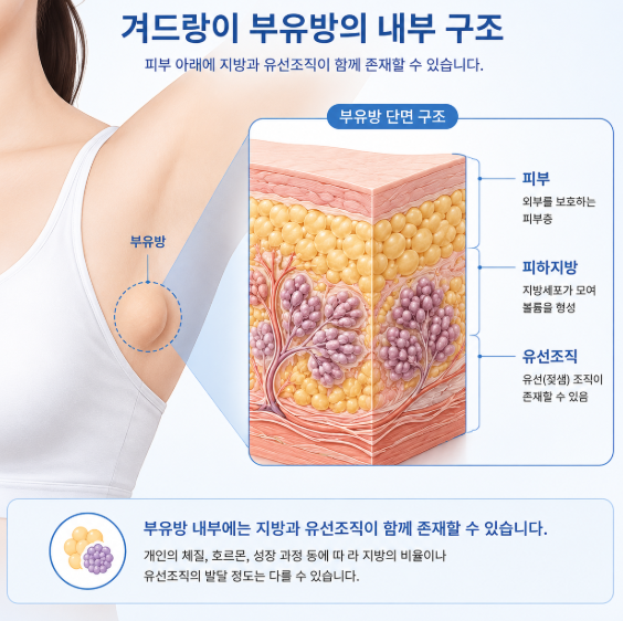 부유방제거수술, 살을 빼도 겨드랑이가 그대로라면? 관련 이미지 6