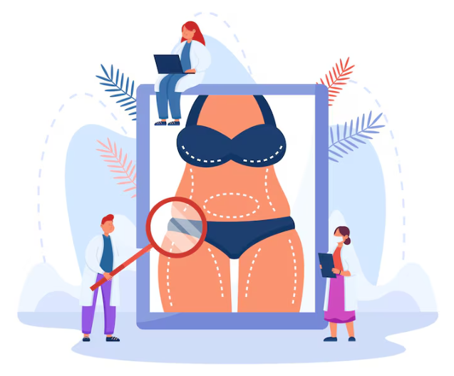 Post-Liposuction Lumpiness Management: Essential Care Tips for Reducing Hardness image 5