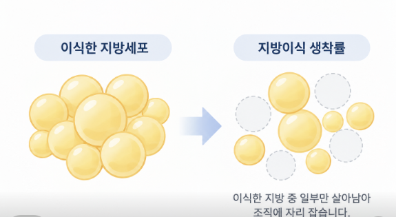 지방이식 생착률, 시간이 지나면 볼륨이 꺼지는 이유 관련 이미지 6