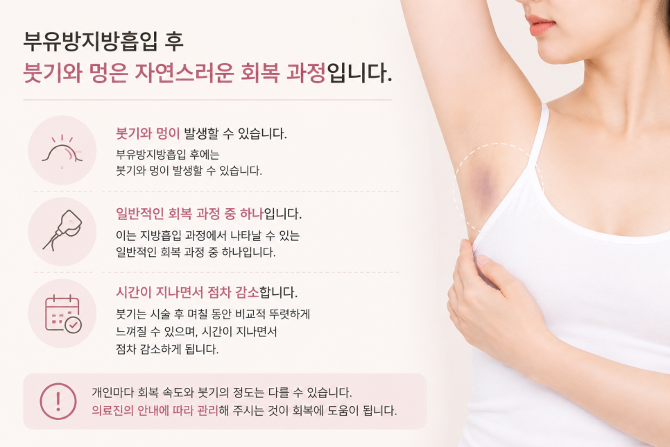 부유방지방흡입 효과 언제부터 보일까? 붓기·부작용·회복기간 총정리 관련 이미지 6