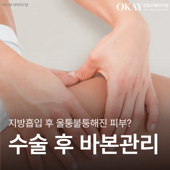 Liposuction Bio-Bond Management: Why It Becomes Uneven and How to Address It image 1