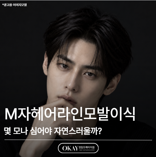 M자헤어라인모발이식, 몇 모나 심어야 자연스러울까? 관련 이미지 1