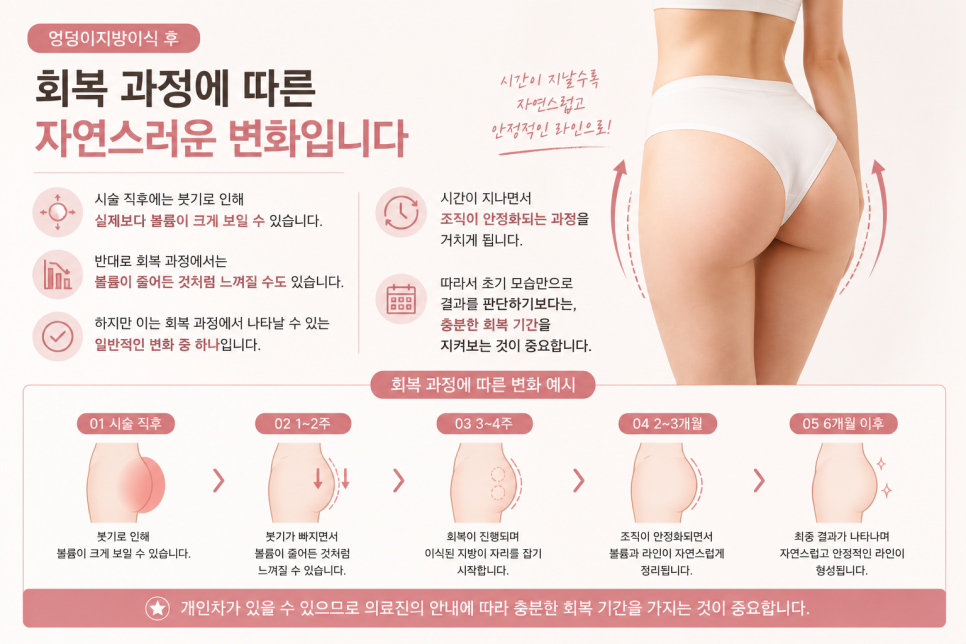 엉덩이지방이식 후 만족도가 갈리는 결정적 차이 관련 이미지 8