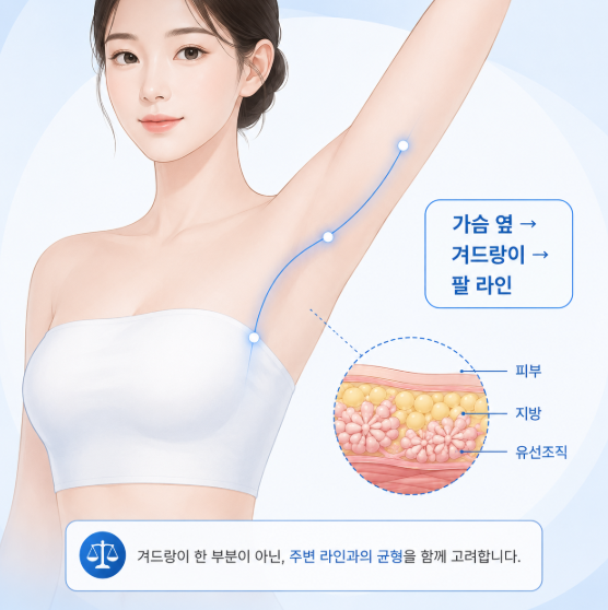 겨드랑이부유방 제거, 지방흡입으로 해결할 수 있을까요? 관련 이미지 9