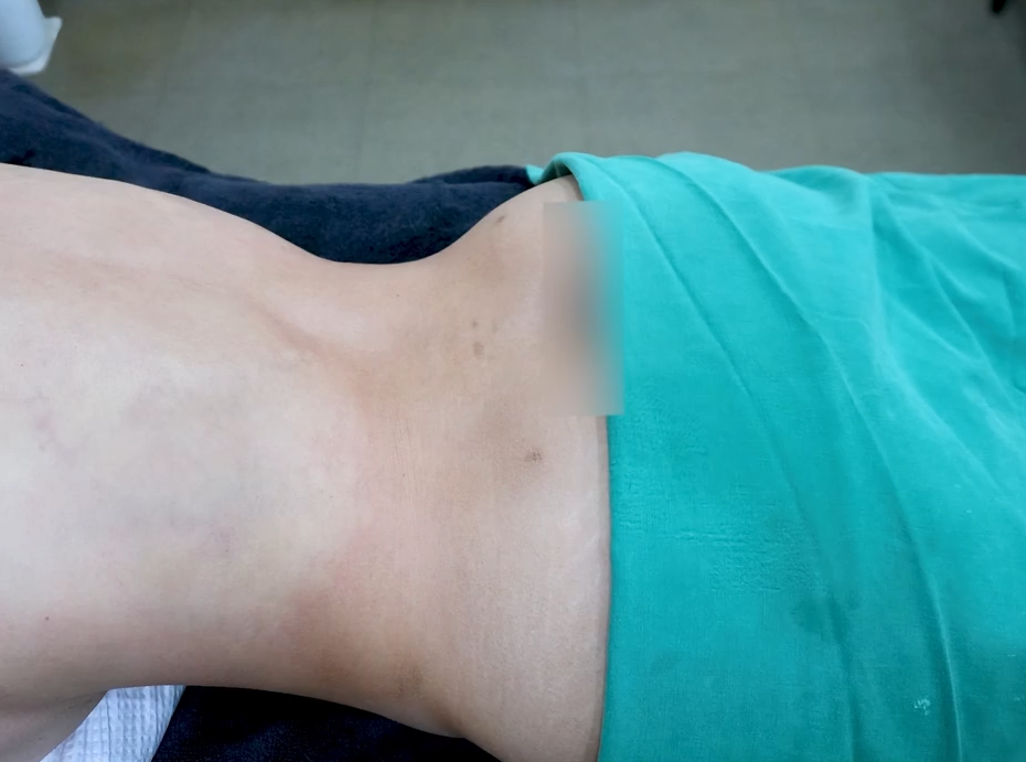 청담동성형외과 잘하는곳 찾는다면 재수술 상담에서 확인해야 할 기준 관련 이미지 7