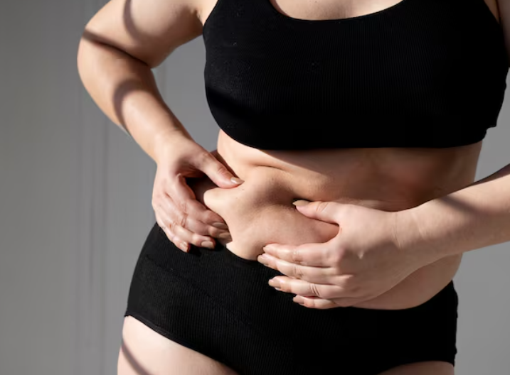 복부지방흡입 후 만족도가 갈리는 이유, 수술보다 중요한 건 따로 있습니다 관련 이미지 3