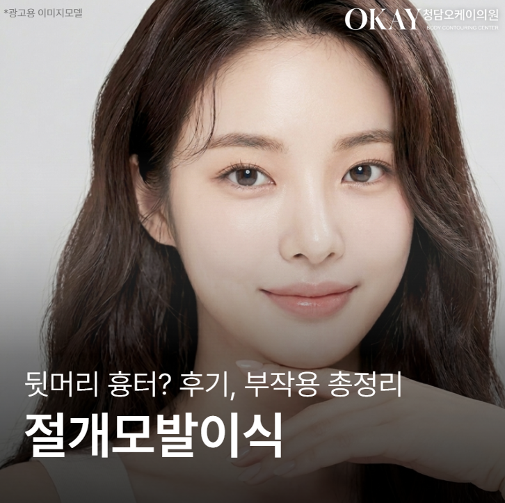 절개모발이식 뒷머리 흉터 얼마나 남나요 &ndash; 후기&middot;부작용 현실 정리 관련 이미지 1