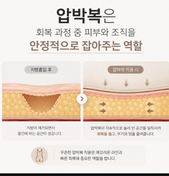 힙딥필러, 골반 옆 꺼진 부분 정말 채울 수 있을까? 관련 이미지 9