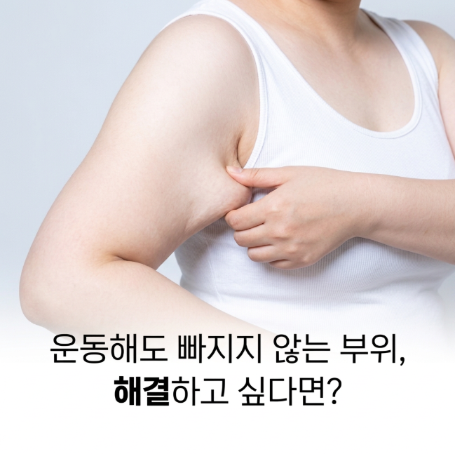신사역성형외과 팔뚝지방흡입 효과 있을까? 팔 라인 변화와 회복 과정 정리 관련 이미지 3